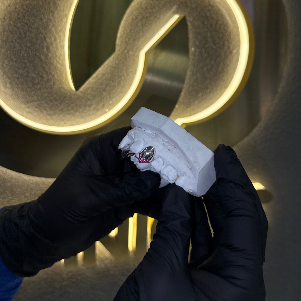 Vampire Fangs | Ruby Tips | Single Canine